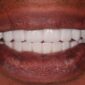Centre Dentaire Oxford Maarif à Casablanca orthodontie