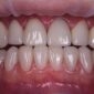 centre dentaire Oxford MEOPA au Maroc la Mauvaise Haleine dentisterie esthétique