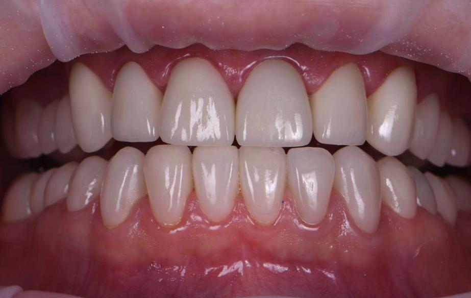 centre dentaire Oxford MEOPA au Maroc la Mauvaise Haleine dentisterie esthétique