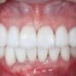 centre dentaire Oxford MEOPA au Maroc la Mauvaise Haleine dentisterie esthétique