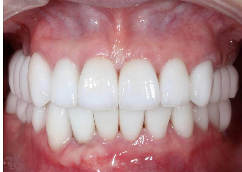 centre dentaire Oxford MEOPA au Maroc la Mauvaise Haleine dentisterie esthétique