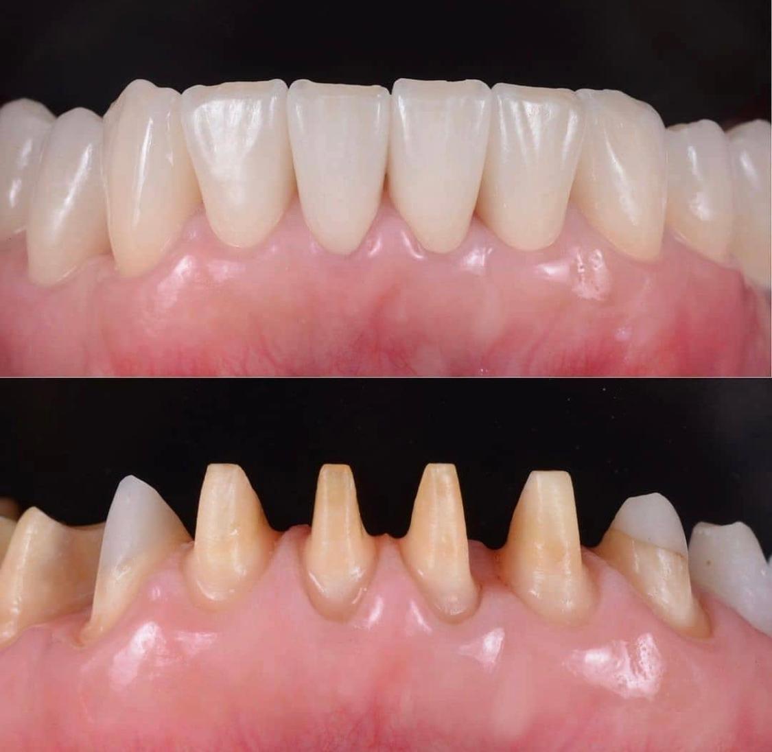 Soins Dentaires dentisterie générale