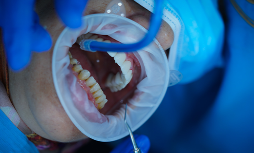 Soins Dentaires dentisterie générale