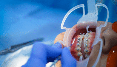 Centre Dentaire Oxford Maarif à Casablanca orthodontie