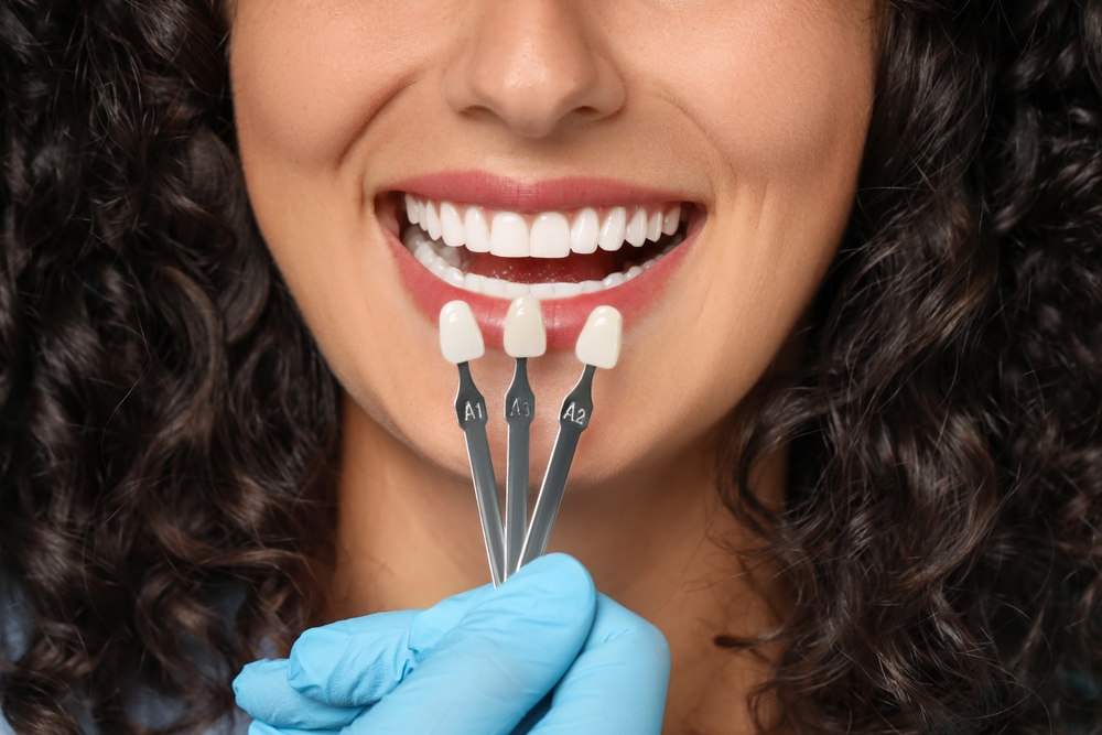 dentisterie esthetique Hollywood smile Centre Dentaire Oxford