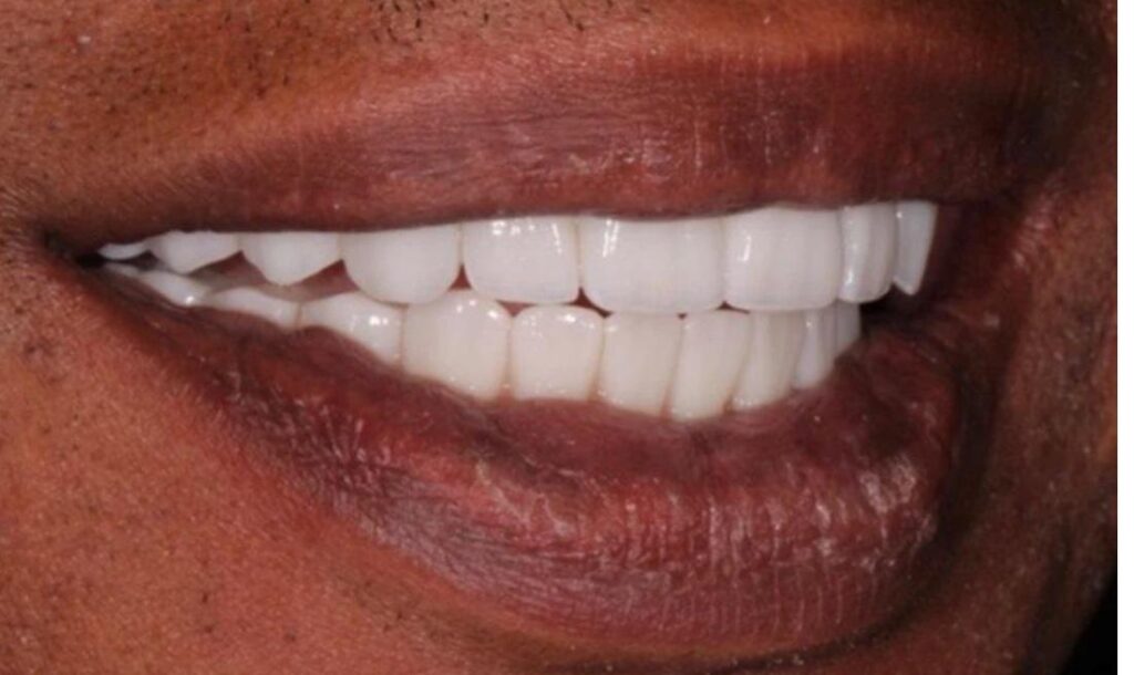 Soins Dentaires Casablanca