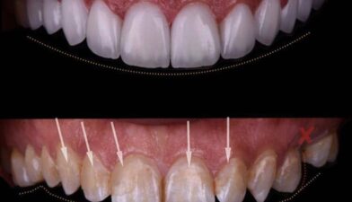 Soins Dentaires Casablanca Premium
