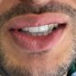 Éco-Dentisterie à Casablanca