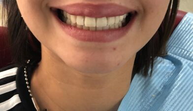 laser dentaire casablanca