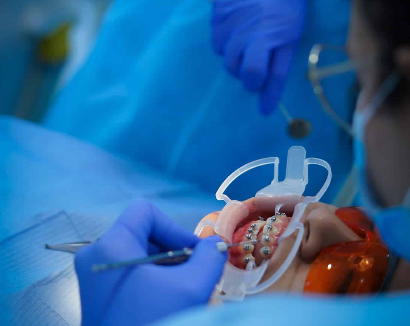 Centre Dentaire Oxford Maarif à Casablanca dents de lait