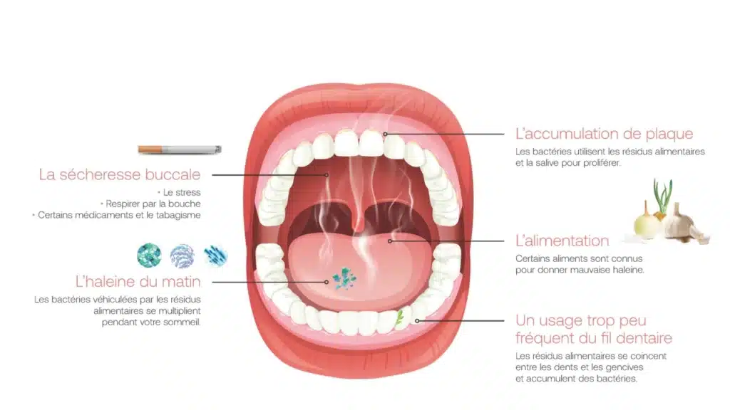 Traiter la Mauvaise Haleine