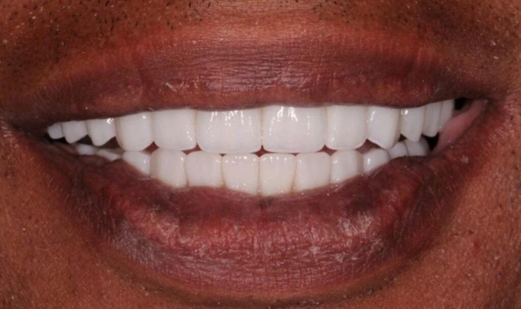 Centre Dentaire Oxford Maarif à Casablanca orthodontie
blanchiment