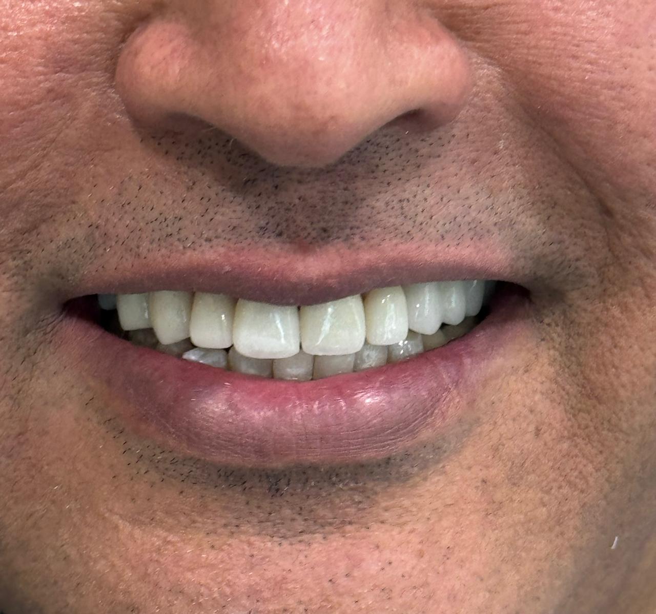 Consultation dentaire Casablanca extraction dent BRUXIME Sensibilité dentaire