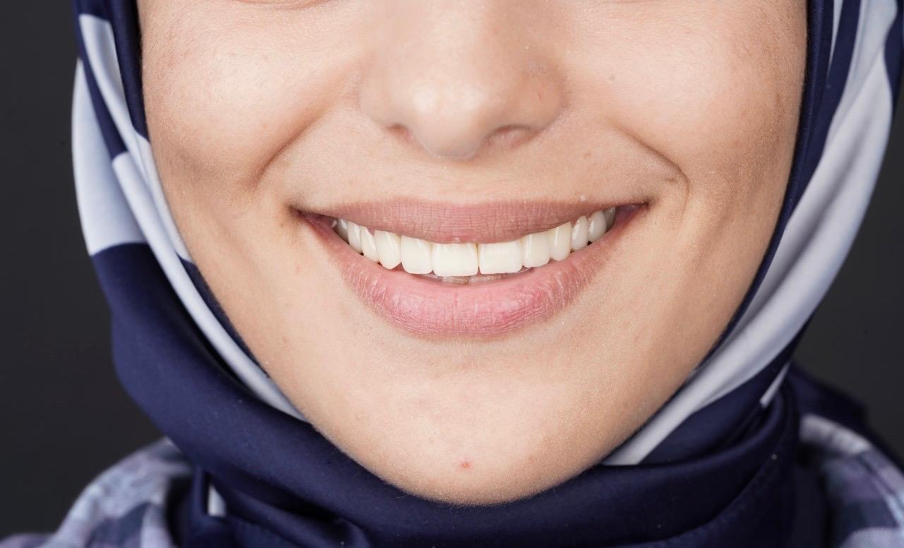 Meilleur Dentiste Casablanca carie dentaire