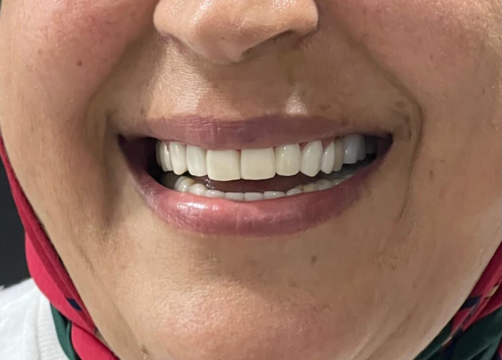 Meilleur Dentiste Casablanca