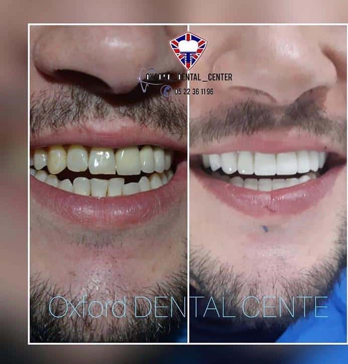 Clinique Dentaire Casablanca 