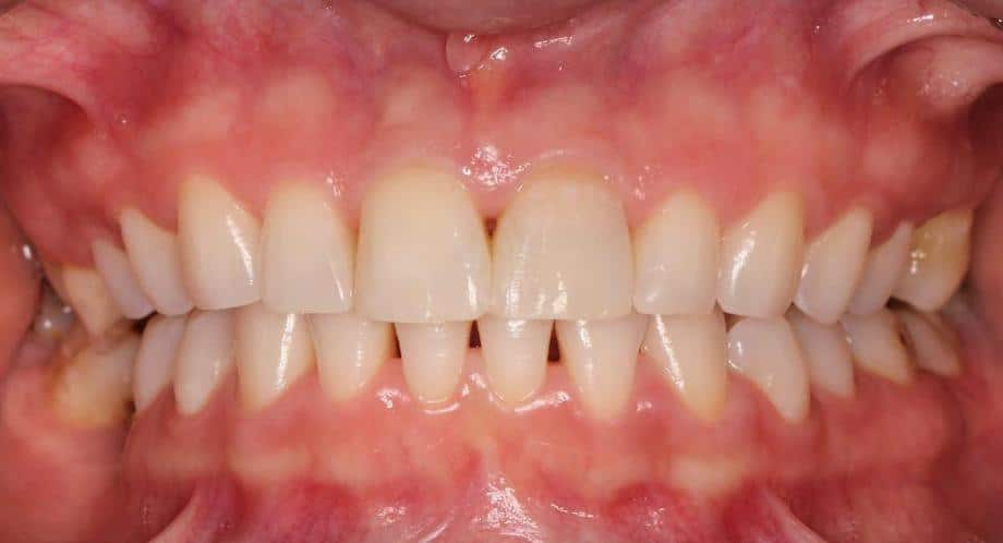 Éco-Dentisterie à Casablanca Centre Dentaire Oxford Maarif à Casablanca