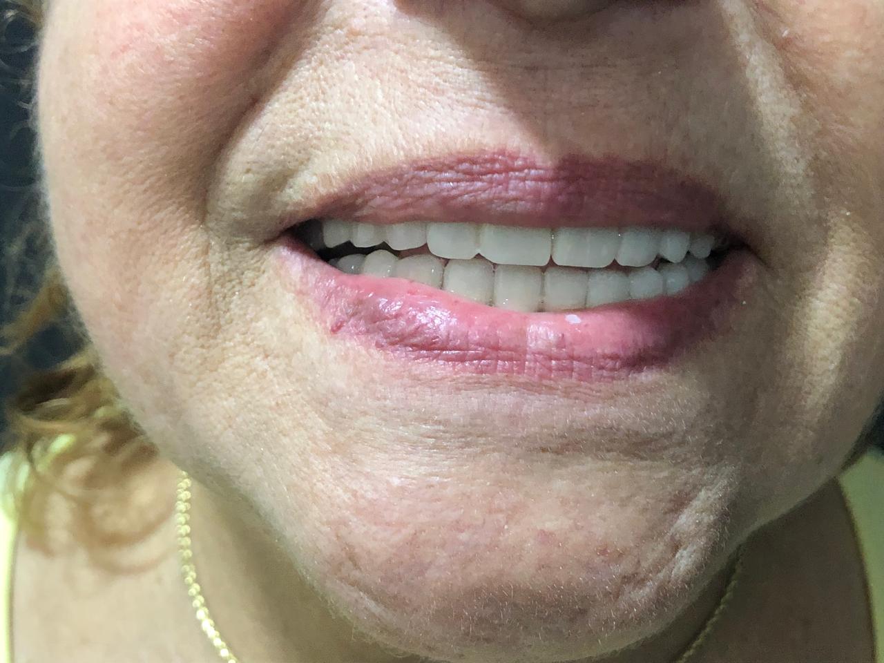 Télédentisterie à Casablanca