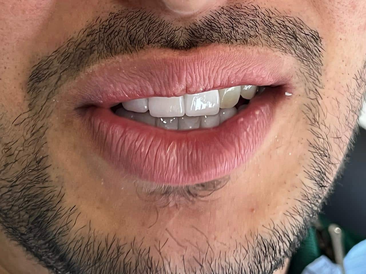 bruxisme centre dentaire Oxford MEOPA au Maroc la Mauvaise Haleine dentisterie esthétique soins dentaires Sensibilité dentaire