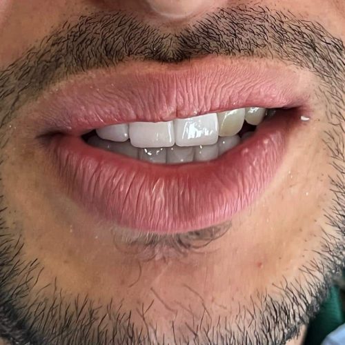 bruxisme centre dentaire Oxford MEOPA au Maroc la Mauvaise Haleine dentisterie esthétique soins dentaires Sensibilité dentaire